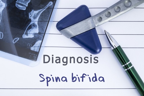 Spina Bifida Birth Injury Lawyer