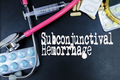 Subconjunctival Hemorrhage Birth Injury Lawyer
