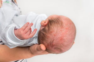 If You File A Lawsuit Against A Doctor For A Birth Injury What Can You Expect?
