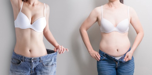 Abdominoplasty And Medical Malpractice Law