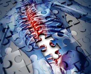 Spinal Cord Injuries Caused by Medical Malpractice